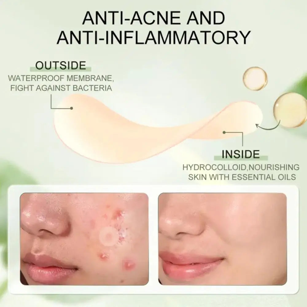 Glaze & Gloss Invisible Acne & Pimple Repair Patches (30-Pack)