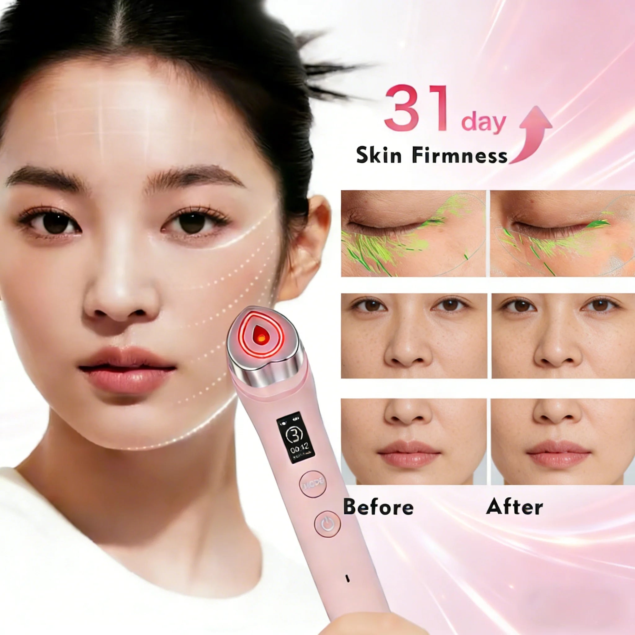 Glaze & Gloss Professional 5-in-1 RF Facial Beauty Device