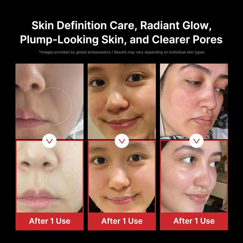 Glaze & Gloss Professional 5-in-1 RF Facial Beauty Device