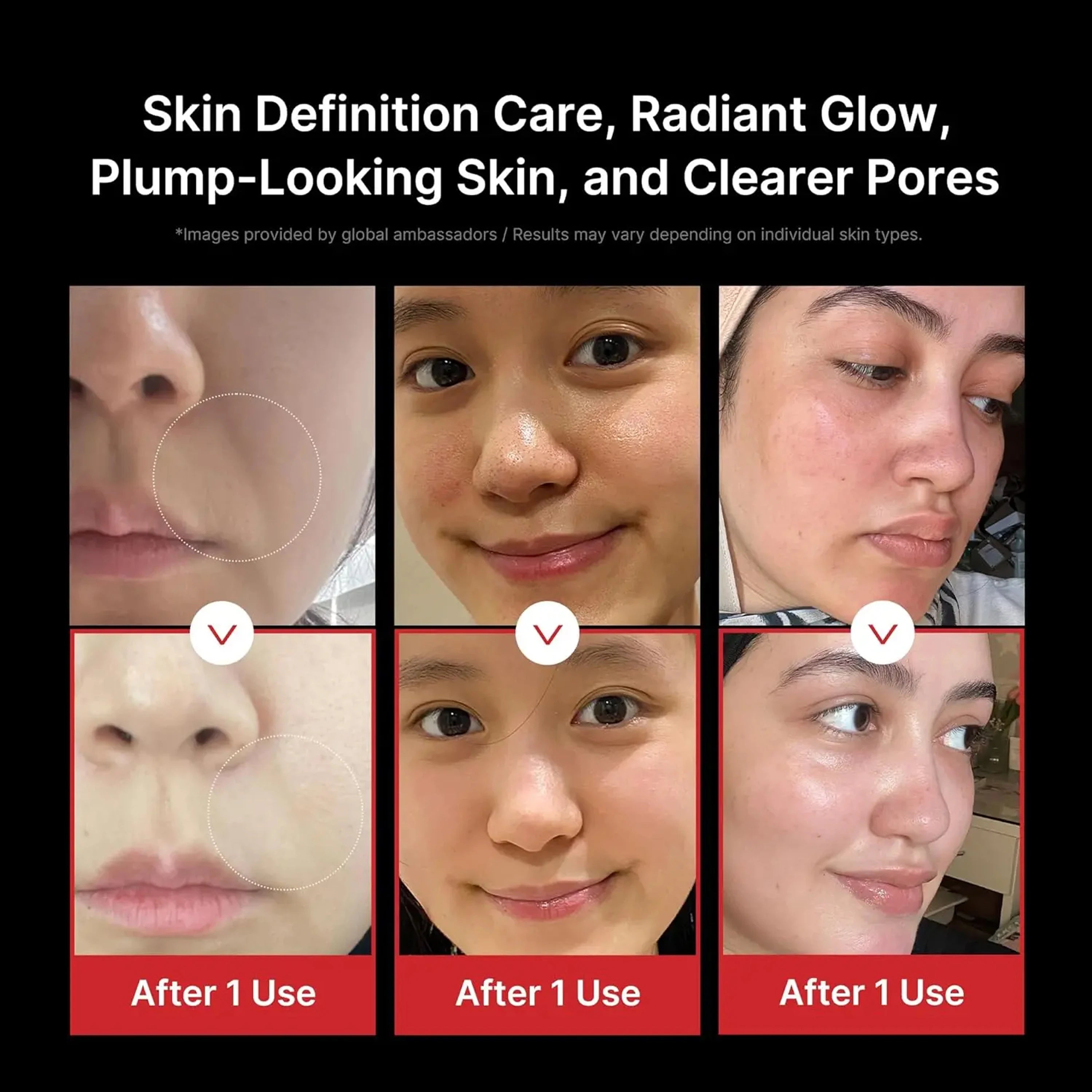 Glaze & Gloss Professional 5-in-1 RF Facial Beauty Device